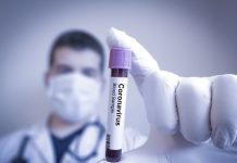 DSÖ’den tüm ülkelere açık çağrı